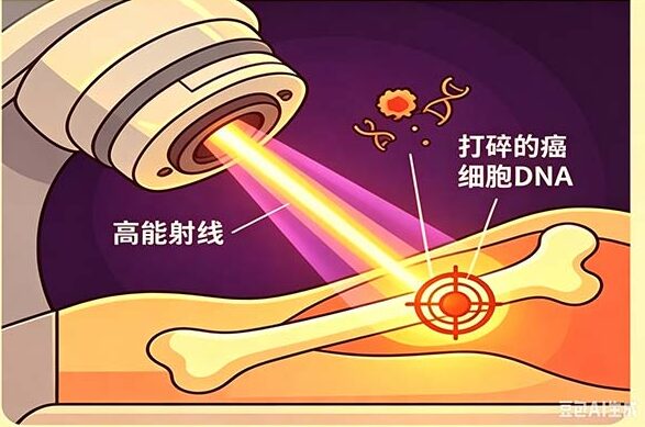 放疗