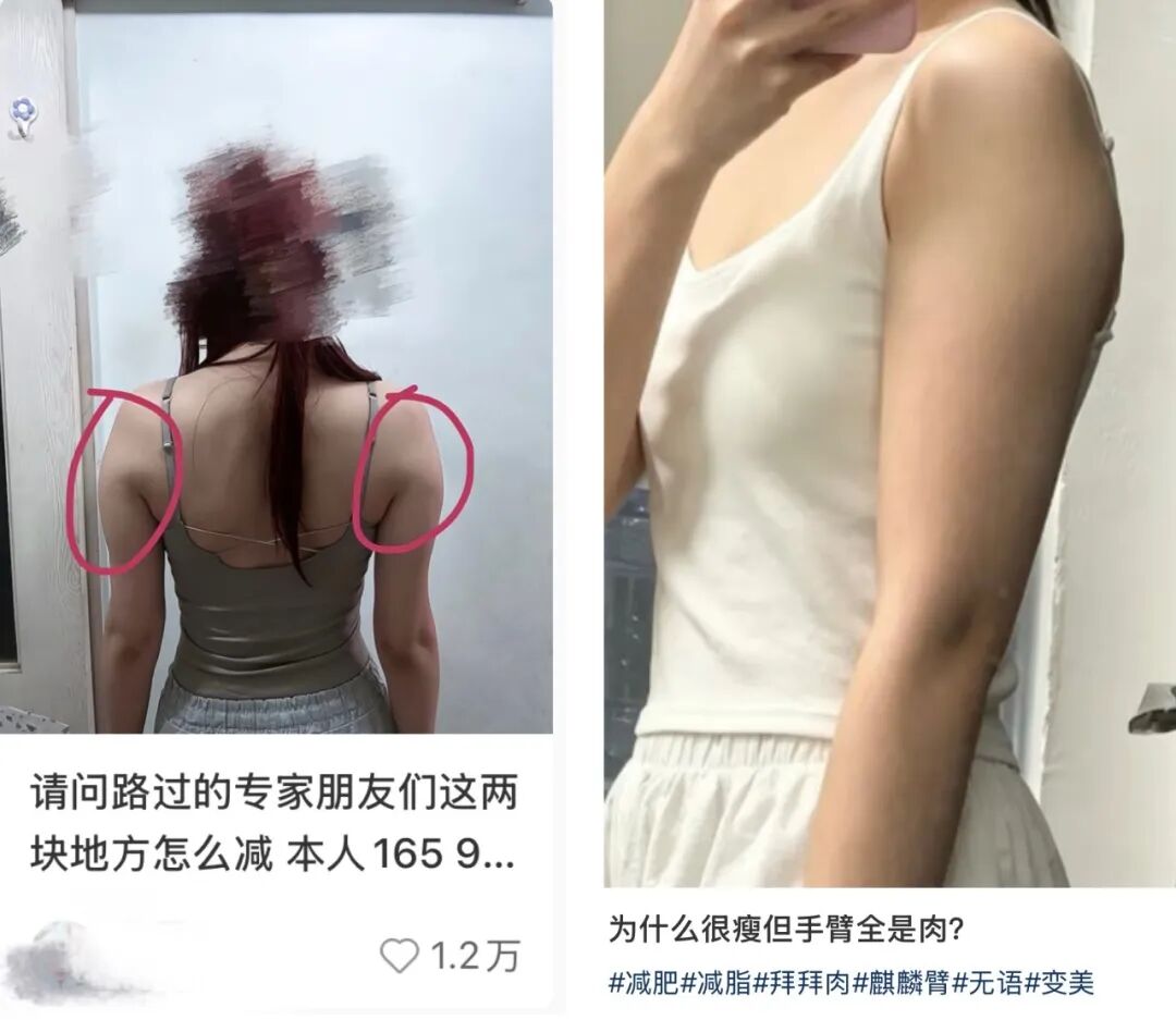 手臂粗未必是坏事:拜拜肉可能是基因彩票