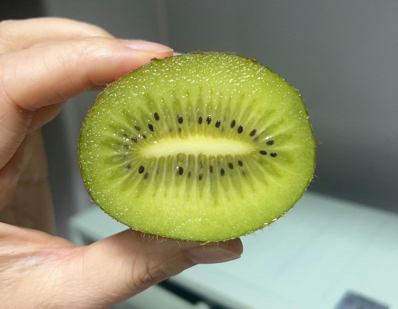 猕猴桃连吃几天吃出电解质紊乱,医生:成人每天一两个就够